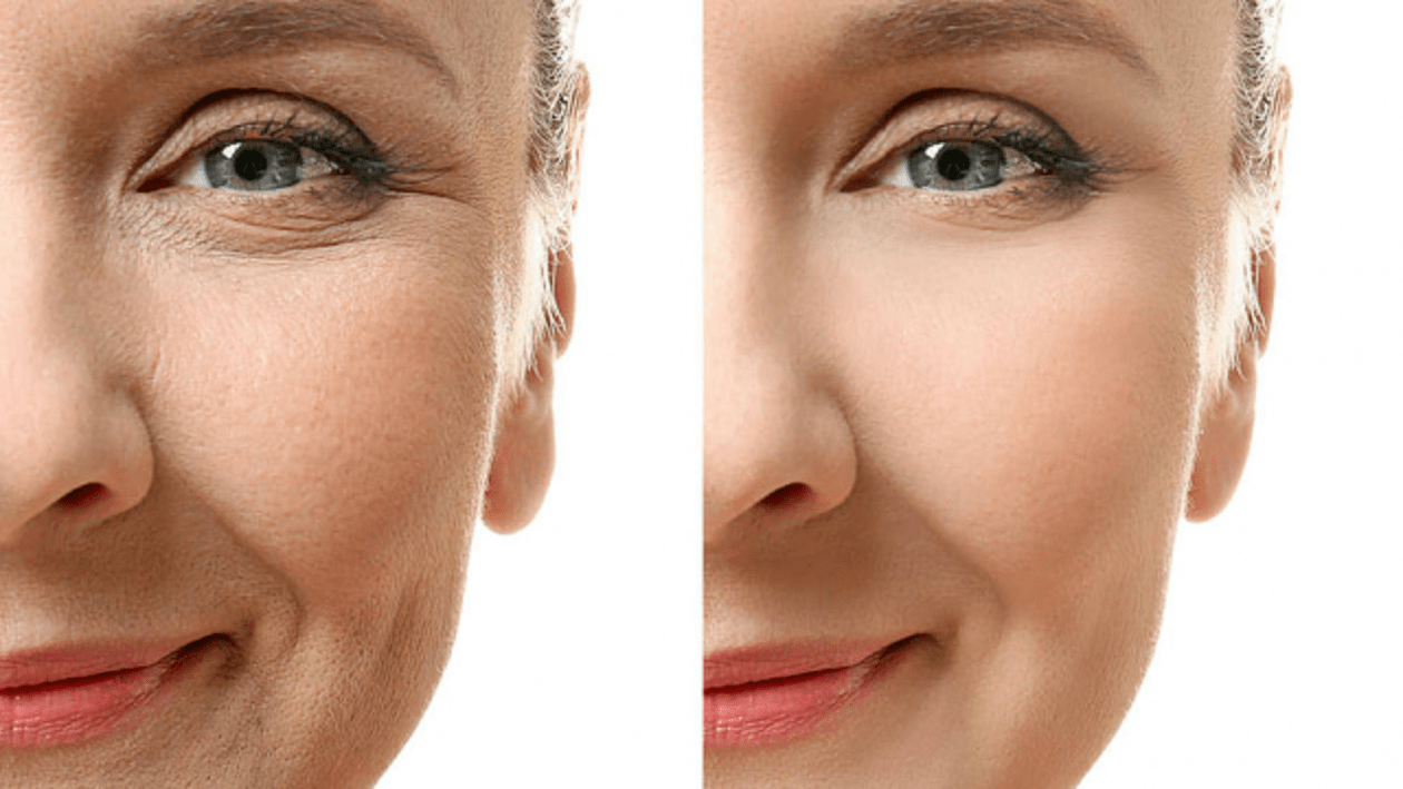 The effect of using Simpla 360 serum on aging skin