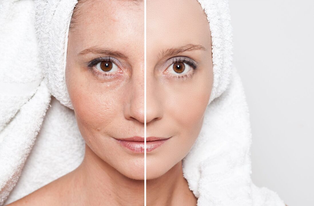 Anti-aging skin treatments