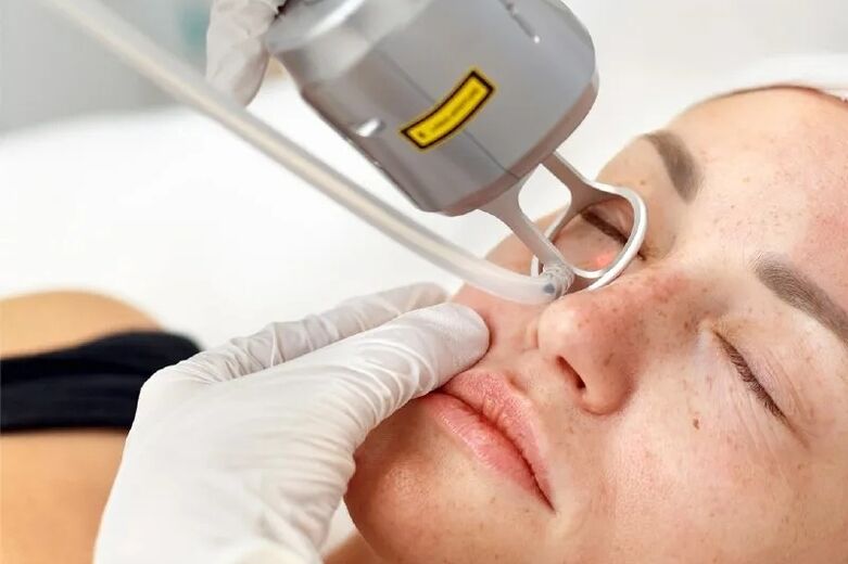 Laser platform for facial skin correction